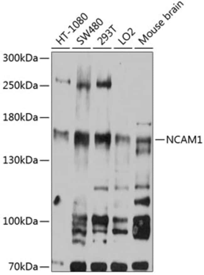 100UL CD56 ANTIBODY 100 ul