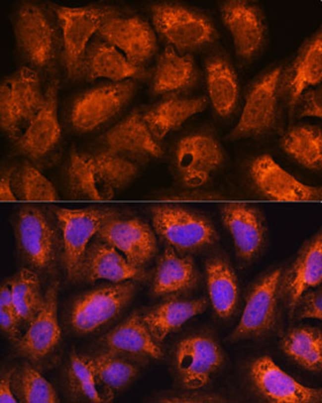 100UL ACAP2 ANTIBODY 100 ul