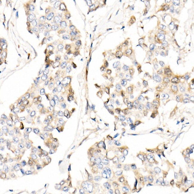 100UL AMID ANTIBODY 100 ul