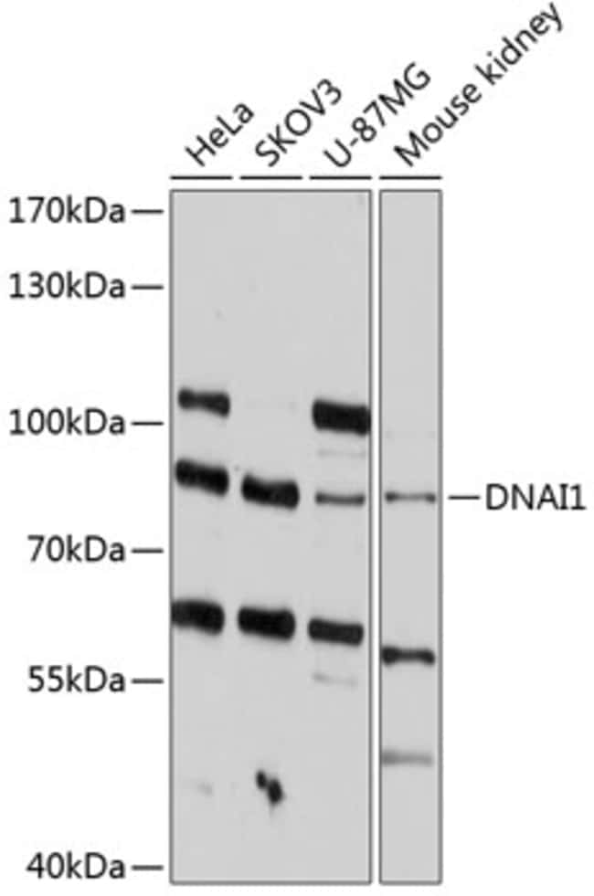 100UL DNAI1 ANTIBODY 100 ul