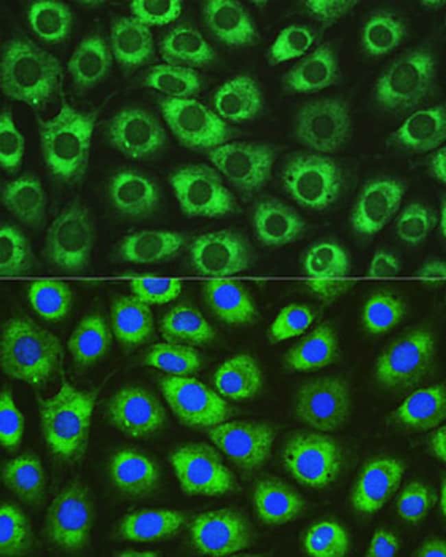 100UL DNAJC10 ANTIBODY 100 ul