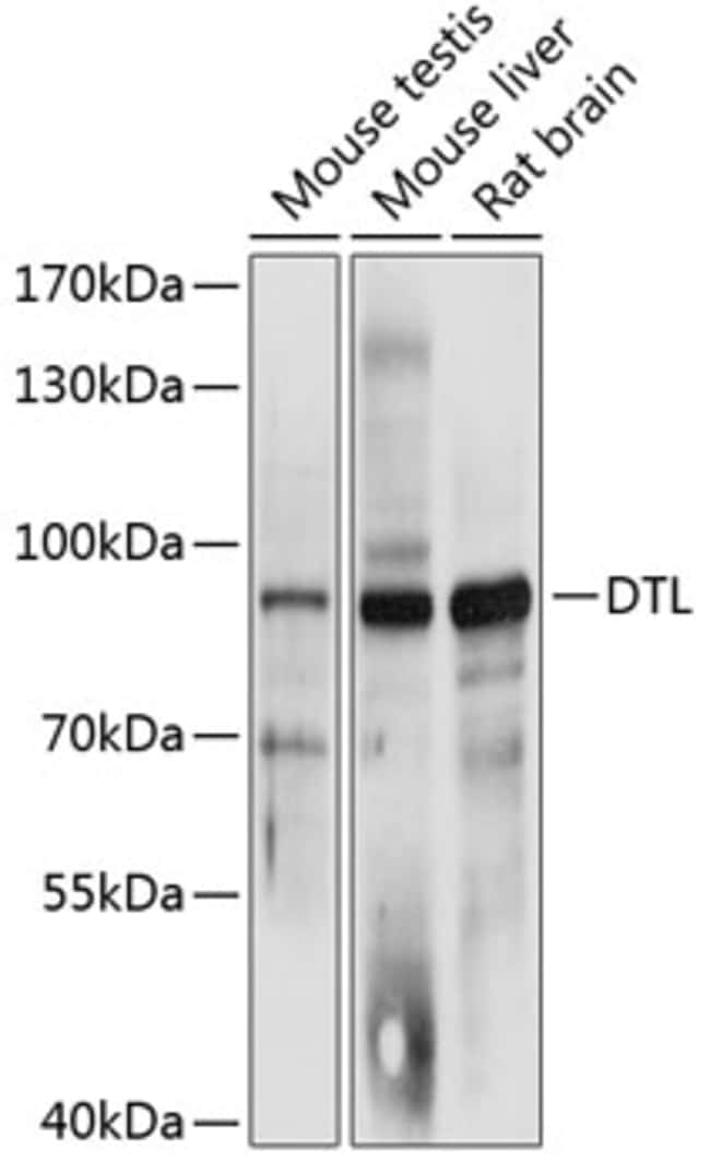 100UL DTL ANTIBODY 100 ul