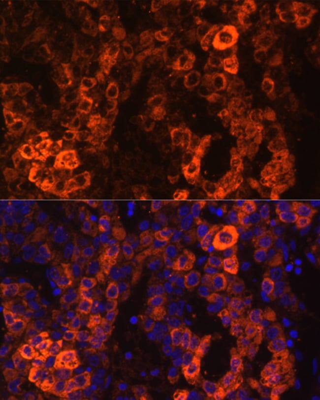 100UL BHMT ANTIBODY 100 ul