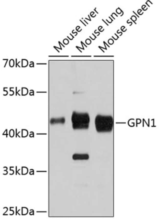 100UL GPN1 ANTIBODY 100 ul