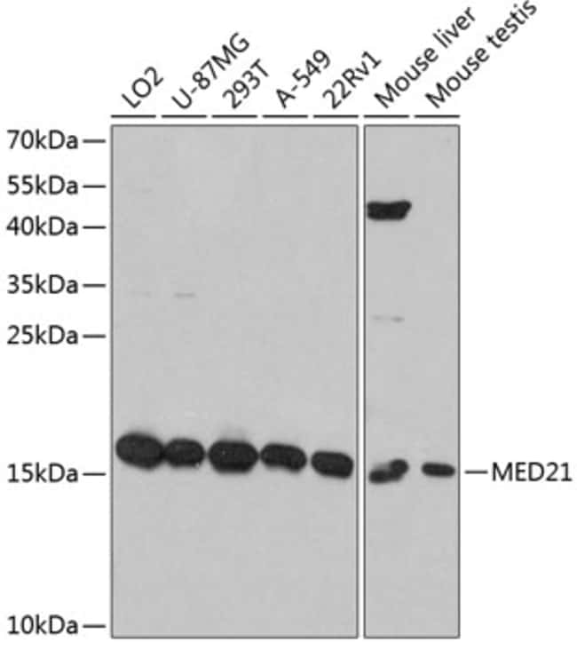 100UL MED21 ANTIBODY 100 ul