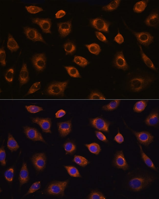 100UL CDH11 ANTIBODY 100 ul