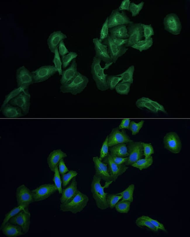 100UL AGTRAP ANTIBODY 100 ul