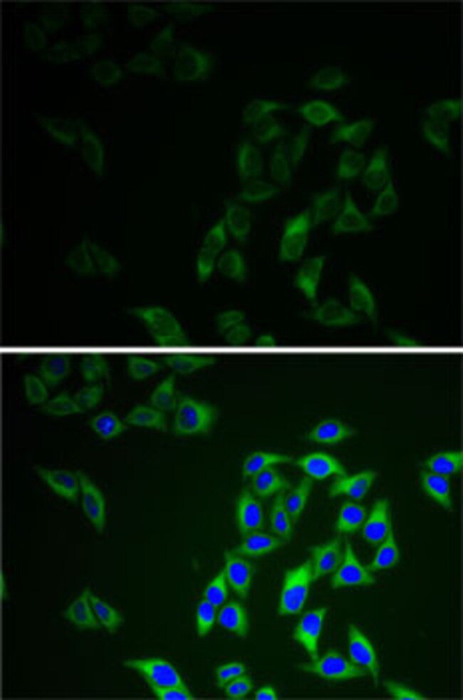 100UL ADENYLATE KINASE 1 ANTIBODY 100 ul