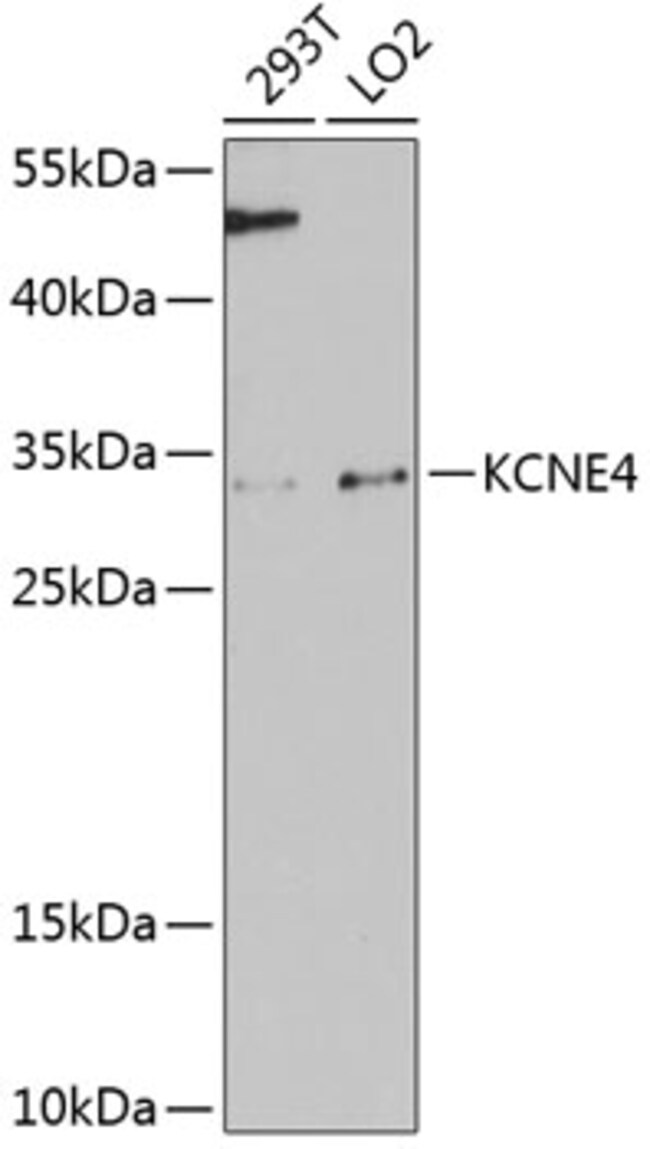 100UL KCNE4 ANTIBODY 100 ul
