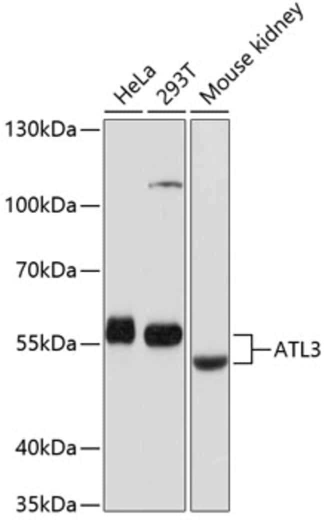 100UL ATL3 ANTIBODY 100 ul
