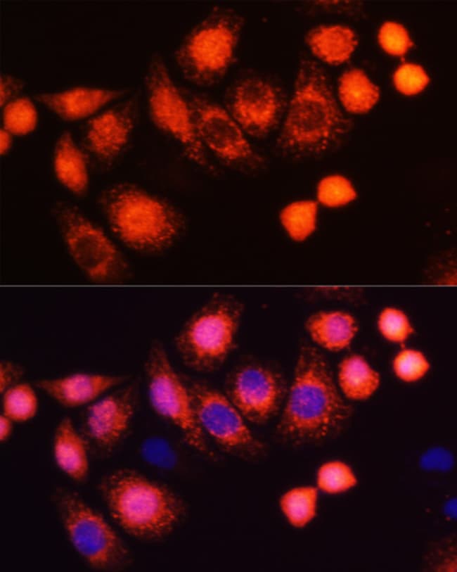 100UL H-RAS ANTIBODY 100 ul