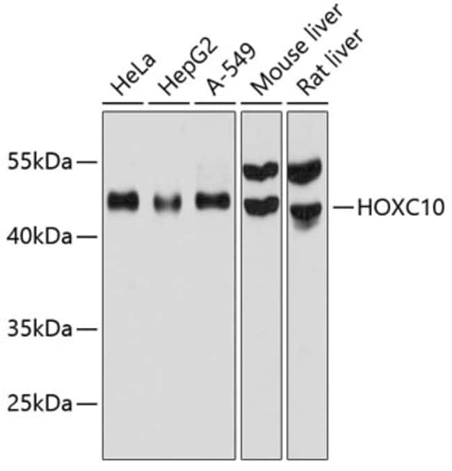 100UL HOXC10 ANTIBODY 100 ul