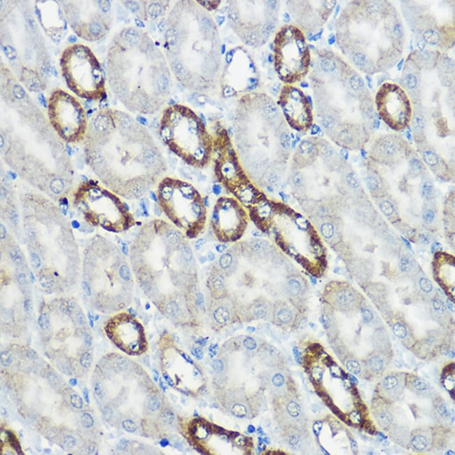 100UL IP6K1 ANTIBODY 100 ul