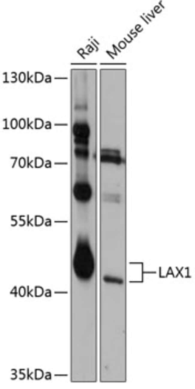 100UL LAX1 ANTIBODY 100 ul