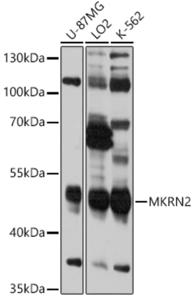 100UL MKRN2 ANTIBODY 100 ul