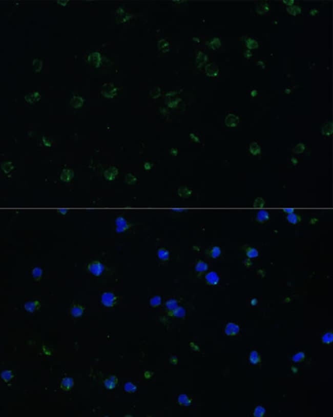 100UL ARHGAP25 ANTIBODY 100 ul