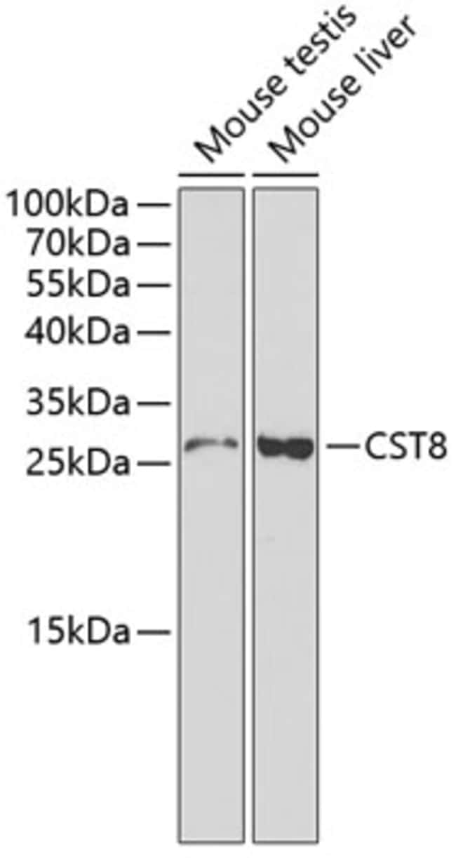 100UL CYSTATIN 8 ANTIBODY 100 ul