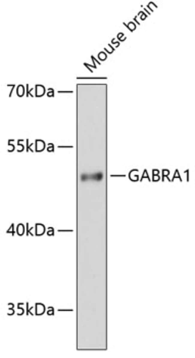 100UL GABRA1 ANTIBODY 100 ul