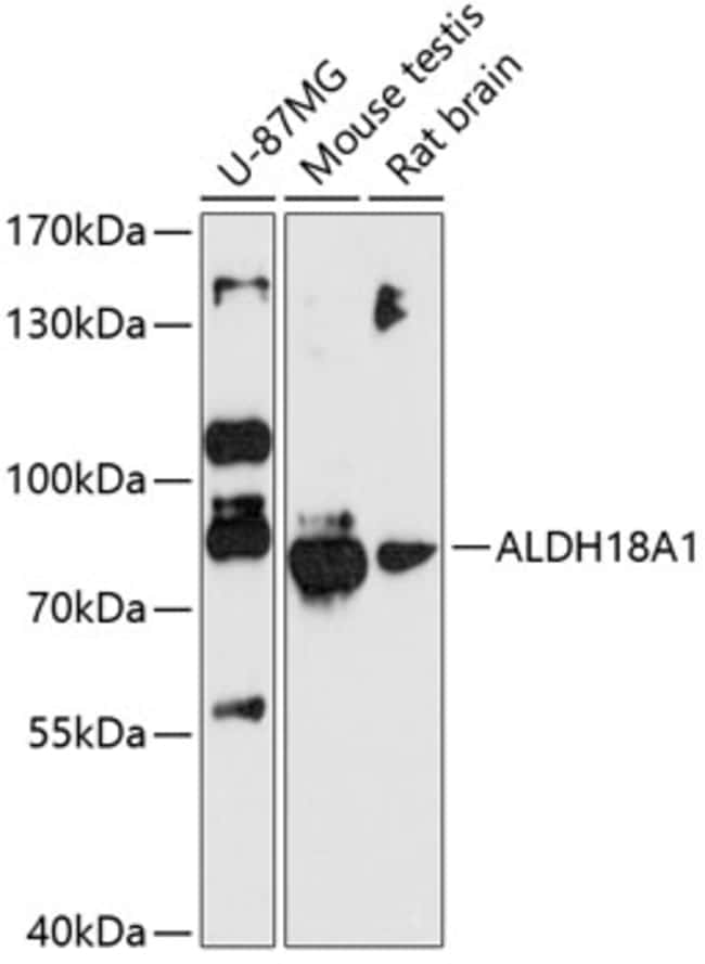 100UL ALDH18A1 ANTIBODY 100 ul