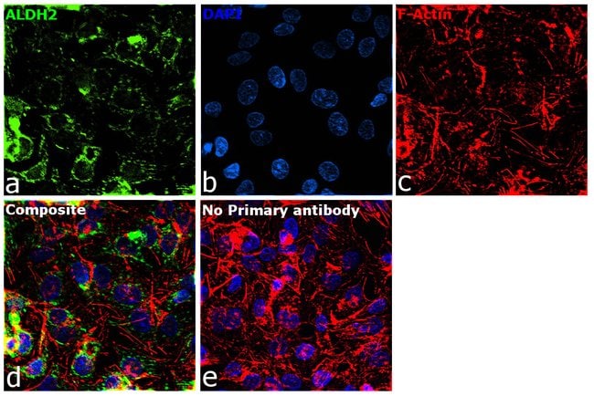 100UL ALDH2 ANTIBODY 100 ul