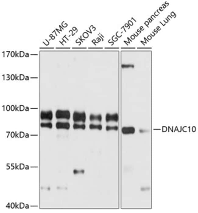 100UL DNAJC10 ANTIBODY 100 ul