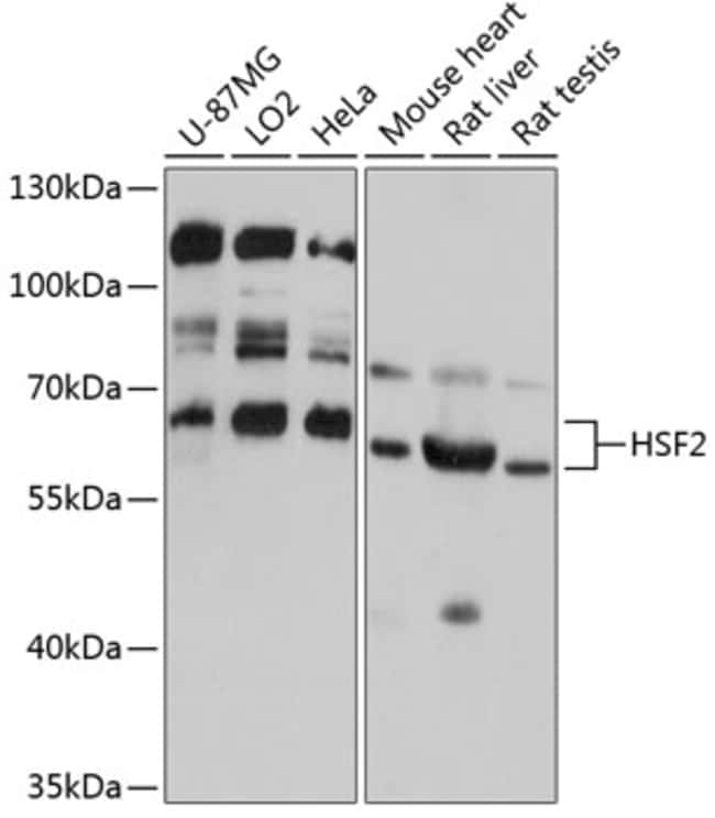 100UL HSF2 ANTIBODY 100 ul