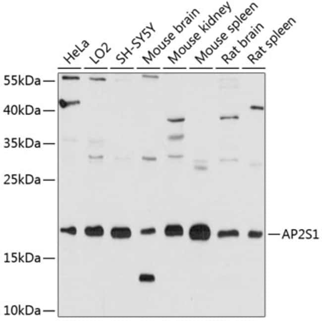 100UL AP2S1 ANTIBODY 100 ul