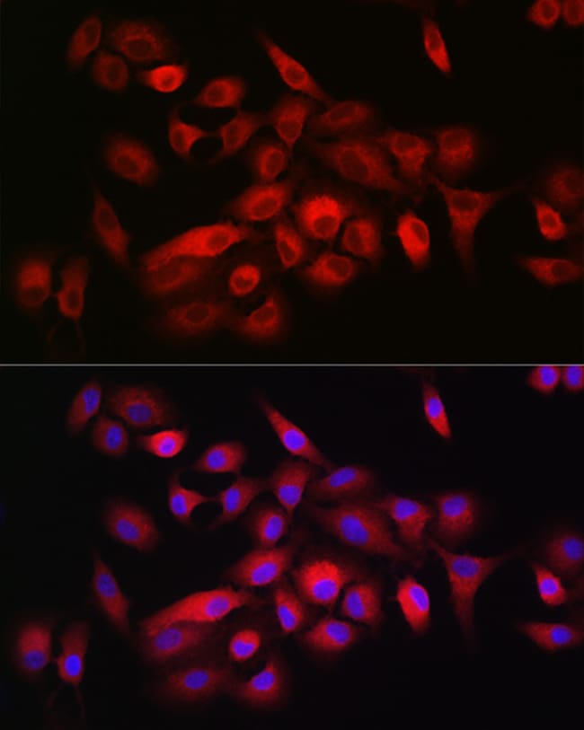 100UL CD55 ANTIBODY 100 ul
