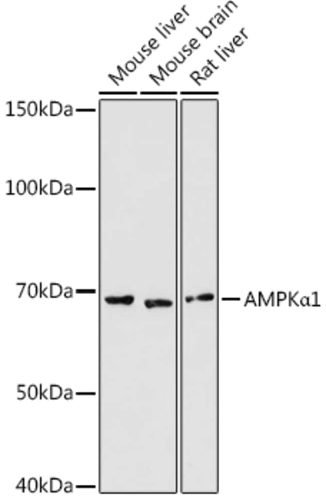 100UL AMPK ALPHA-1 ANTIBODY 100 ul
