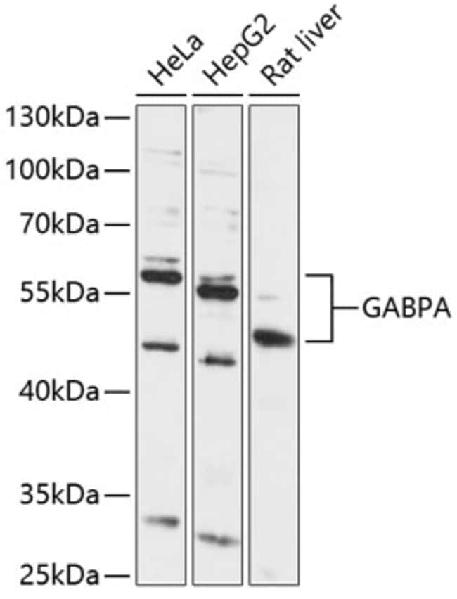100UL GABPA ANTIBODY 100 ul