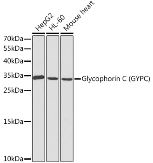 100UL GYPC ANTIBODY 100 ul