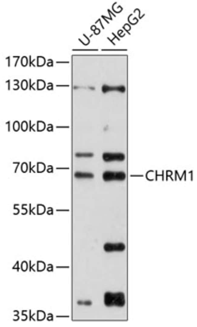 100UL CHRM1 ANTIBODY 100 ul