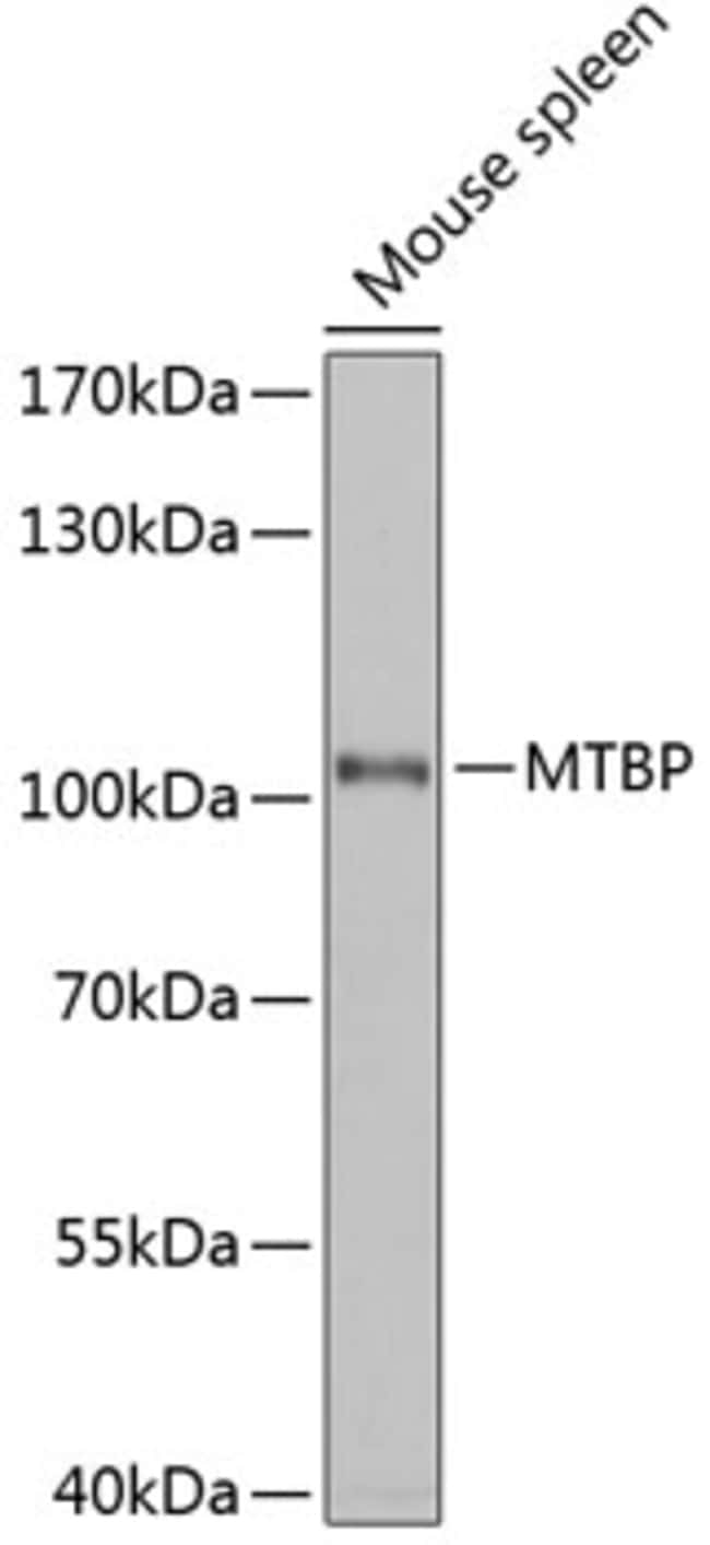 100UL MTBP ANTIBODY 100 ul