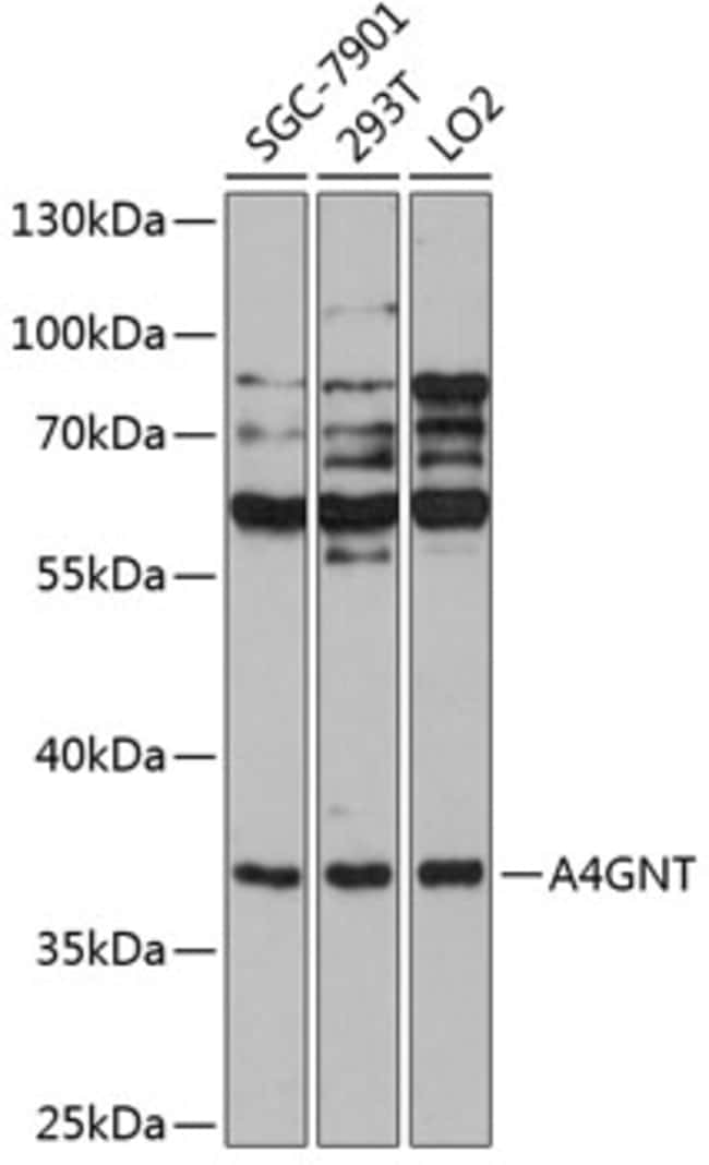 100UL A4GNT ANTIBODY 100 ul