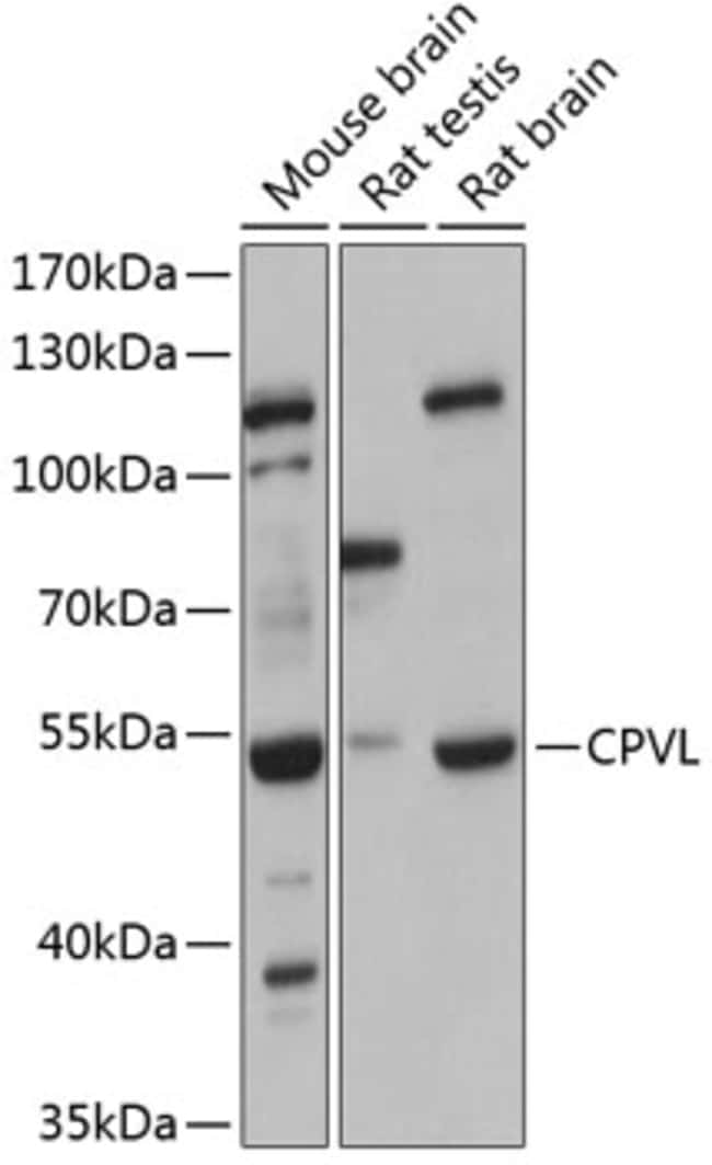 100UL CPVL ANTIBODY 100 ul
