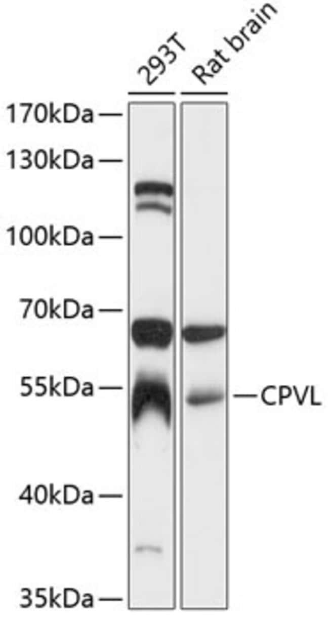 100UL CPVL ANTIBODY 100 ul