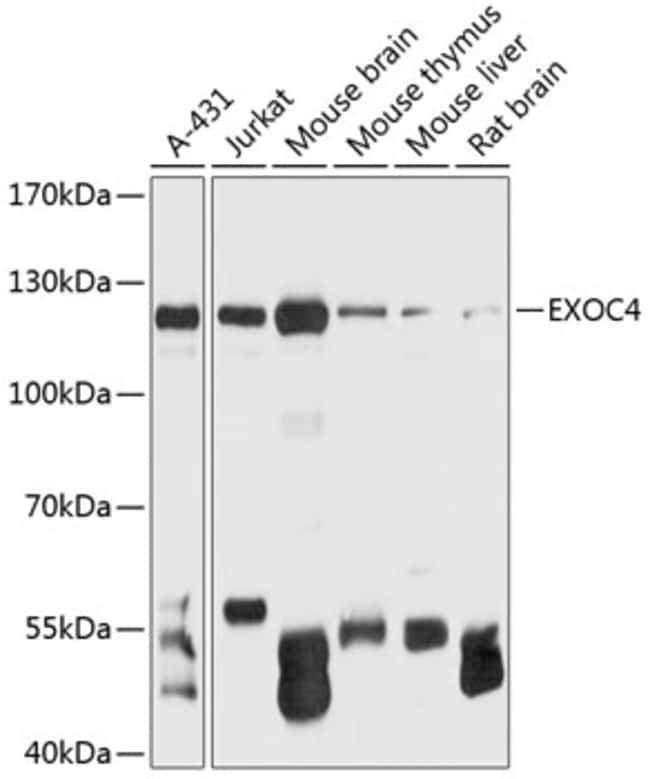 100UL EXOC4 ANTIBODY 100 ul