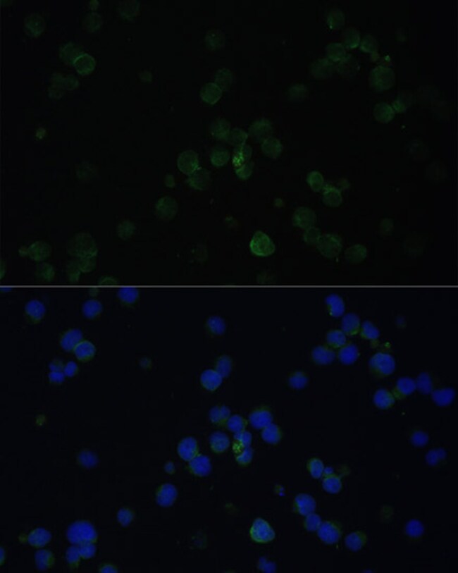 100UL CD3D ANTIBODY 100 ul