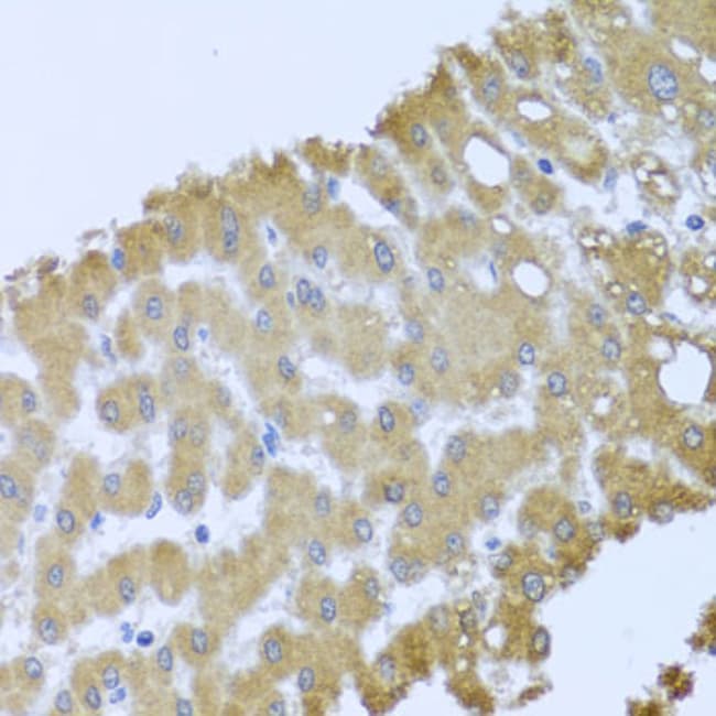 100UL ACID PHOSPHATASE 1 ANTIBODY 100 ul