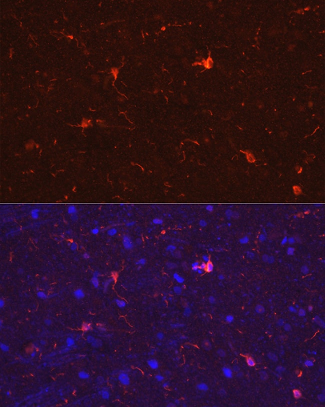 100UL IBA1 ANTIBODY 100 ul