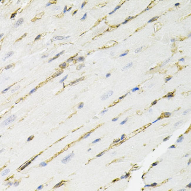 100UL ANNEXIN A2 ANTIBODY 100 ul