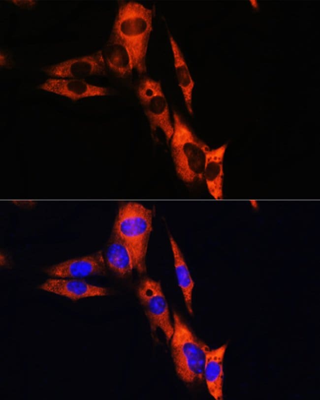 100UL ATP1B1 ANTIBODY 100 ul