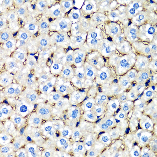 100UL BETA-2 MICROGLOBULIN ANTIBODY 100