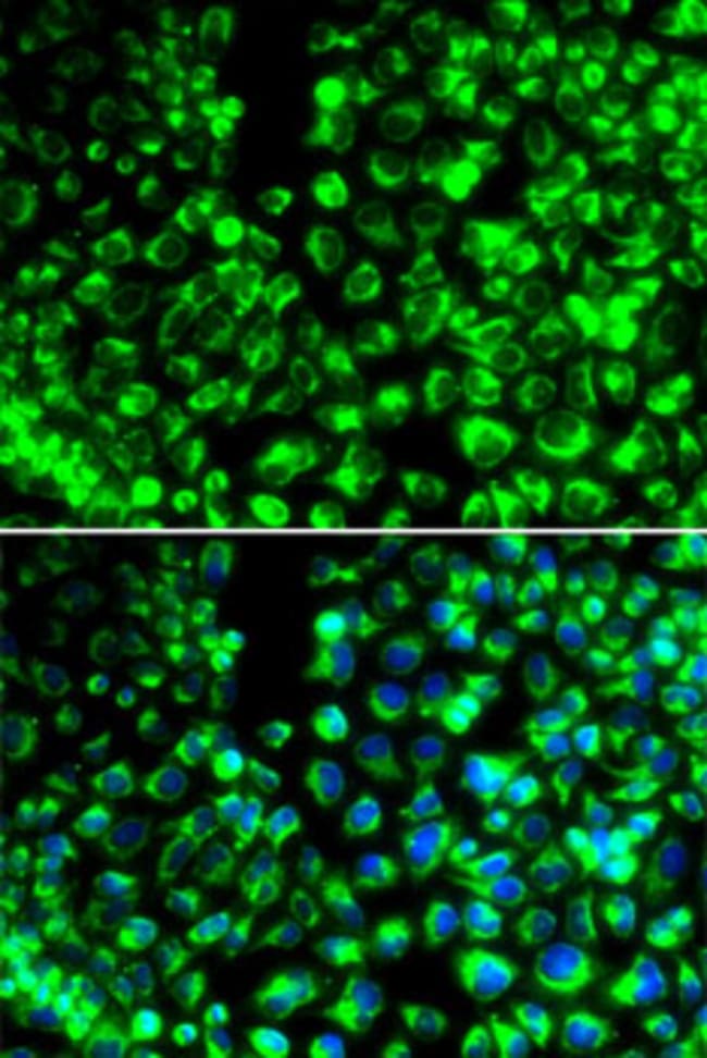 100UL CALUMENIN ANTIBODY 100 ul