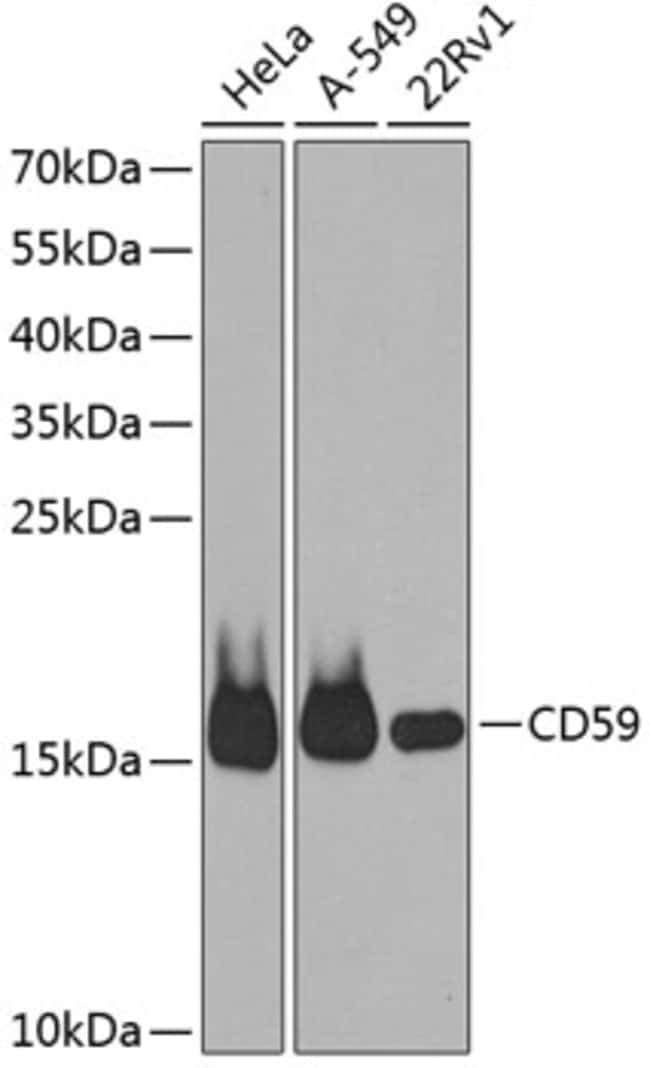 100UL CD59 ANTIBODY 100 ul