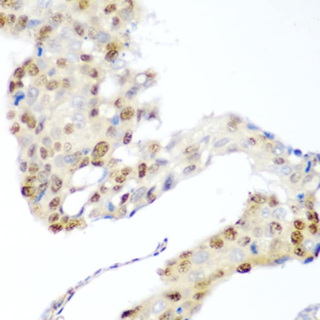 100UL CDK1 ANTIBODY 100 ul