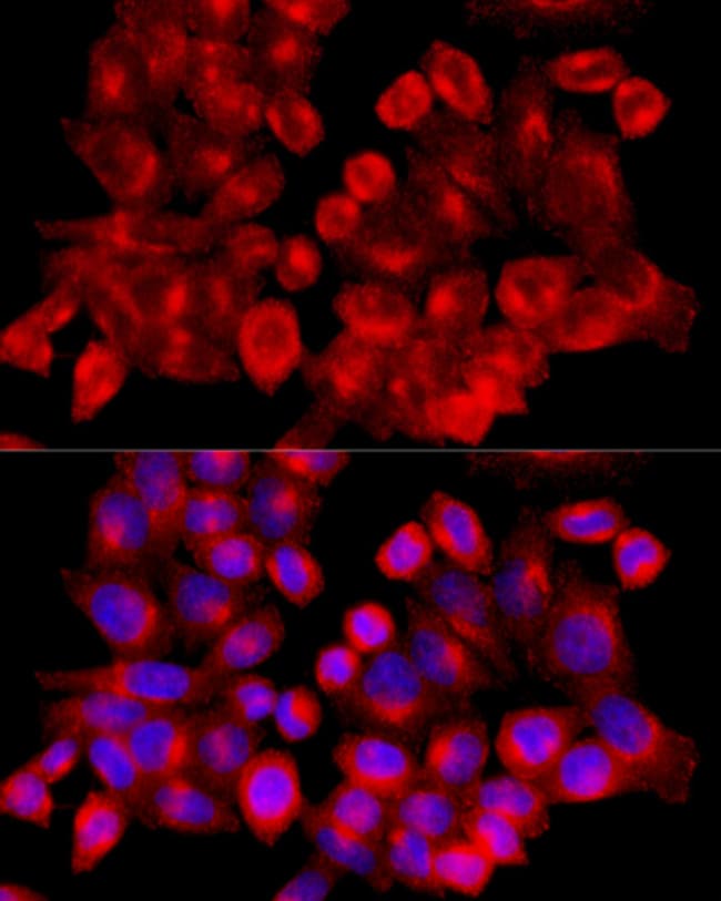 100UL CLATHRIN HEAVY CHAIN ANTIBODY 100