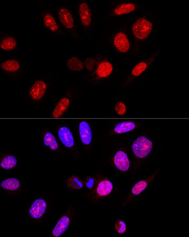 100UL ATAXIN 3 ANTIBODY 100 ul
