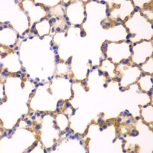 100UL EPB41 ANTIBODY 100 ul