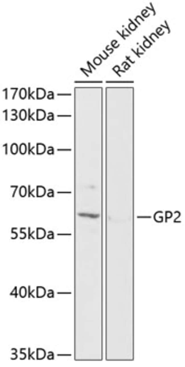 100UL GP2 ANTIBODY 100 ul